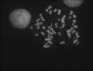 Microscope image of cells with dicentric chromosones
